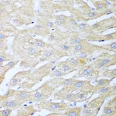 Anti-NUDT15 antibody used in IHC (Paraffin sections) (IHC-P). GTX32759