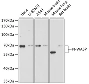 Anti-N-WASP antibody used in Western Blot (WB). GTX32762