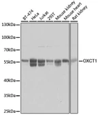 Anti-OXCT1 antibody used in Western Blot (WB). GTX32770