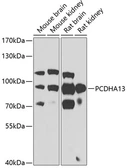 Anti-PCDHA13 antibody used in Western Blot (WB). GTX32774