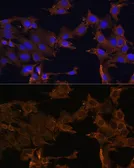 Anti-PDGF Receptor beta antibody used in Immunocytochemistry/ Immunofluorescence (ICC/IF). GTX32777