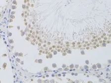 Anti-PHC1 antibody used in IHC (Paraffin sections) (IHC-P). GTX32784