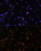 Anti-PLCG2 antibody used in Immunocytochemistry/ Immunofluorescence (ICC/IF). GTX32793