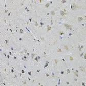 Anti-PPA1 antibody used in IHC (Paraffin sections) (IHC-P). GTX32802