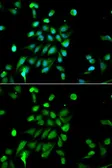Anti-PSMC5 antibody used in Immunocytochemistry/ Immunofluorescence (ICC/IF). GTX32819