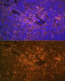 Anti-S100A12 antibody used in IHC (Paraffin sections) (IHC-P). GTX32854