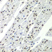 Anti-SF3B2 antibody used in IHC (Paraffin sections) (IHC-P). GTX32869