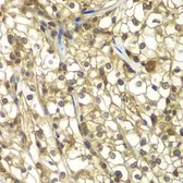 Anti-SULT2B1 antibody used in IHC (Paraffin sections) (IHC-P). GTX32904