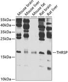 Anti-THRSP antibody used in Western Blot (WB). GTX32922