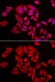 Anti-TLK2 antibody used in Immunocytochemistry/ Immunofluorescence (ICC/IF). GTX32923