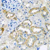 Anti-UQCR10 antibody used in IHC (Paraffin sections) (IHC-P). GTX32954
