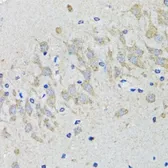 Anti-5-HT2B receptor antibody used in IHC (Paraffin sections) (IHC-P). GTX32984