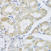 Anti-ATPIF1 antibody used in IHC (Paraffin sections) (IHC-P). GTX33029