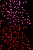 Anti-BAF57 antibody used in Immunocytochemistry/ Immunofluorescence (ICC/IF). GTX33031