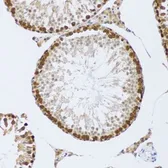 Anti-CIRBP antibody used in IHC (Paraffin sections) (IHC-P). GTX33096