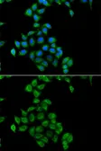 Anti-COQ3 antibody used in Immunocytochemistry/ Immunofluorescence (ICC/IF). GTX33110