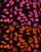 Anti-Cytokeratin 5 antibody used in Immunocytochemistry/ Immunofluorescence (ICC/IF). GTX33140