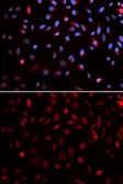 Anti-ERCC1 antibody used in Immunocytochemistry/ Immunofluorescence (ICC/IF). GTX33185
