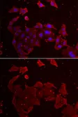 Anti-FLCN antibody used in Immunocytochemistry/ Immunofluorescence (ICC/IF). GTX33200