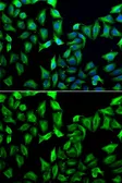 Anti-Guanine deaminase antibody used in Immunocytochemistry/ Immunofluorescence (ICC/IF). GTX33233