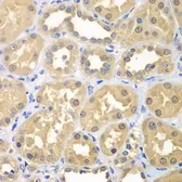 Anti-Ketohexokinase antibody used in IHC (Paraffin sections) (IHC-P). GTX33283