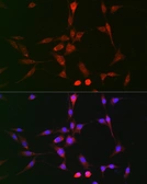 Anti-LOX antibody used in Immunocytochemistry/ Immunofluorescence (ICC/IF). GTX33299