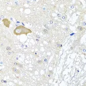 Anti-MCCC2 antibody used in IHC (Paraffin sections) (IHC-P). GTX33308