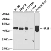 Anti-NR2E1 antibody used in Western Blot (WB). GTX33364