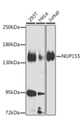 Anti-NUP155 antibody used in Western Blot (WB). GTX33372