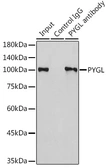 Anti-PYGL antibody used in Immunoprecipitation (IP). GTX33448