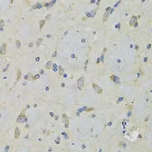 Anti-RAE1 antibody used in IHC (Paraffin sections) (IHC-P). GTX33456