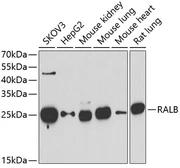 Anti-RALB antibody used in Western Blot (WB). GTX33457