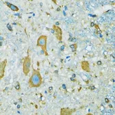 Anti-RPS7 antibody used in IHC (Paraffin sections) (IHC-P). GTX33479