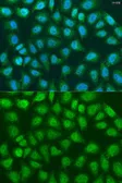 Anti-SOCS4 antibody used in Immunocytochemistry/ Immunofluorescence (ICC/IF). GTX33513