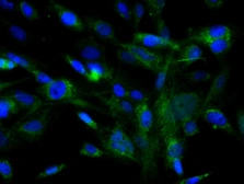 Anti-c-Kit antibody used in Immunocytochemistry/ Immunofluorescence (ICC/IF). GTX33947