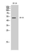 Anti-5-HT3D receptor antibody used in Western Blot (WB). GTX34001
