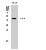 Anti-5-HT6 receptor antibody used in Western Blot (WB). GTX34002