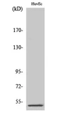 Anti-PPP2R3C antibody used in Western Blot (WB). GTX34137