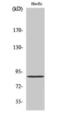Anti-CGK2 antibody used in Western Blot (WB). GTX34144
