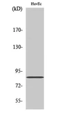 Anti-ALS2CR8 antibody used in Western Blot (WB). GTX34160