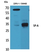 Anti-Surfactant protein A2 antibody used in Western Blot (WB). GTX34193