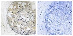 Anti-CD2BP2 antibody used in IHC (Paraffin sections) (IHC-P). GTX34212