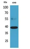 Anti-CGR19 antibody used in Western Blot (WB). GTX34291