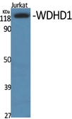 Anti-WDHD1 antibody used in Western Blot (WB). GTX34296