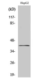 Anti-CHKL antibody used in Western Blot (WB). GTX34299