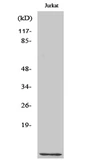 Anti-CKS1 antibody used in Western Blot (WB). GTX34316