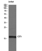 Anti-Cystatin SN antibody used in Western Blot (WB). GTX34332