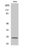 Anti-AK5 antibody used in Western Blot (WB). GTX34359