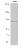 Anti-FARP2 antibody used in Western Blot (WB). GTX34372