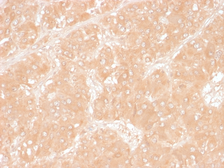Anti-ADFP antibody [ADFP/1366] used in IHC (Paraffin sections) (IHC-P). GTX34396